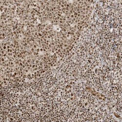CKS2 Antibody, Novus Biologicals 0.1mL; Unlabeled:Antibodies, Polyclonal